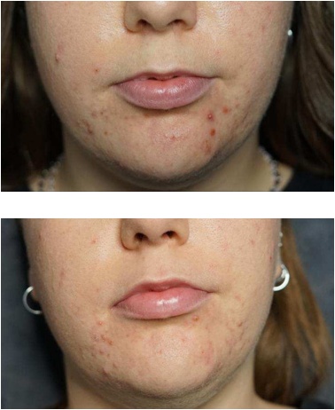 Tudatos arcápolás a Vagheggi szemléletében, ahol a szalicilsav a bőr egyensúlyát támogató rendszer része